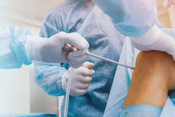 Arthroscopy Surgery