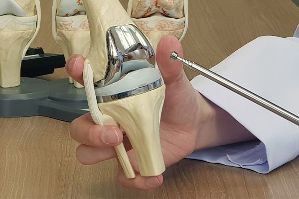 Knee Replacement Surgery