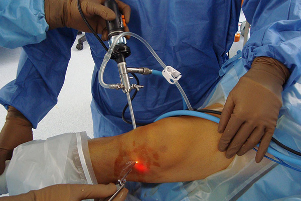 Meniscus Repair Surgery